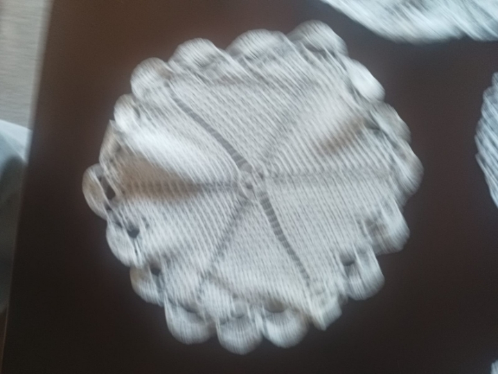 Ručno rađena čipka