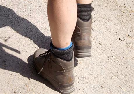  Kronična ruptura mišića potkoljenice