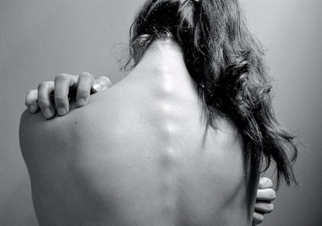 Prilagodba kralježnice