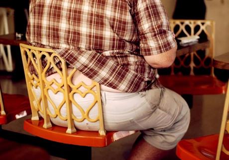 Metabolički sindrom ili sindrom X