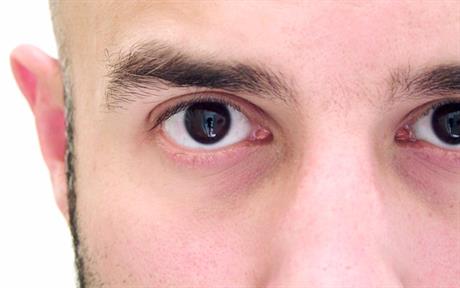 Novosti iz svijeta oftalmologije – jedinstvena laserska korekcija  dioptrije bez dodira oka