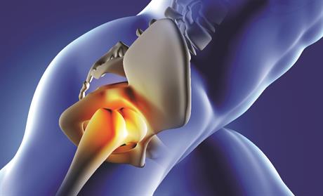 Izokinetičko testiranje kuka