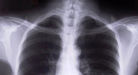 Kakvi su nam srce i pluća?