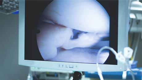 Liječenje bolesti zglobova artroskopskim zahvatom