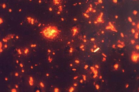 Tuberkuloza – simptomi, dijagnostika i liječenje