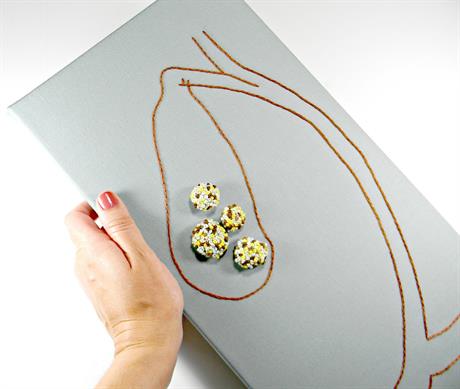 Pitanja čitatelja: Trebam li odstraniti žučnu vrećicu?
