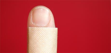 Postupak prilikom ozljede na radu