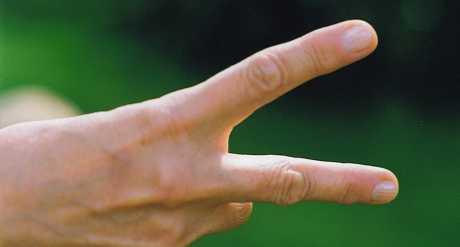 Škljocanje zglobova