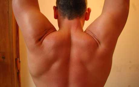 Sindrom sraza ramena