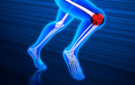 Parcijalna ruptura prednjeg križnog ligamenta